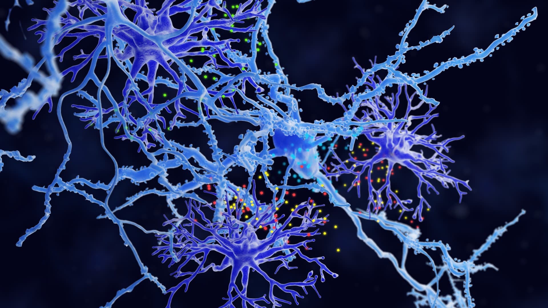 Neural network
